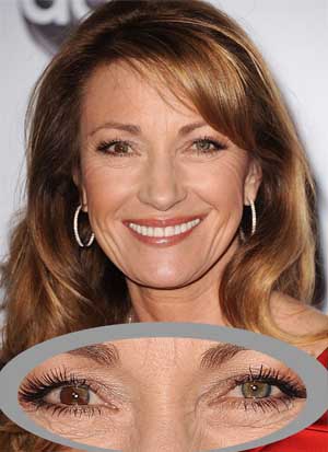 jane seymour eyes two different colors