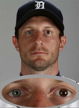 max scherzer eyes