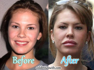 Nikki Cox Plastic Surgery Overdone Fillers Before After Pictures Celebritieswith Com