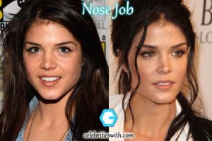 Marie Avgeropoulos Nose Job, Plastic Surgery, Before & After Pictures