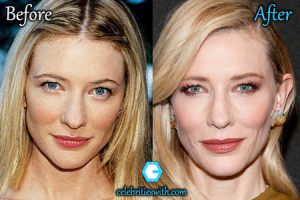 CelebritiesWith.com - All About Celebrity Plastic Surgery