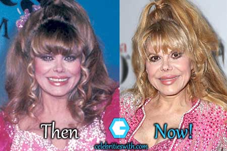 Charo Plastic Surgery, Boob Job, Nose Job, Fillers Before After ...