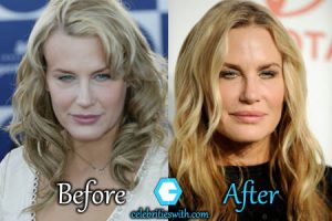 Daryl Hannah Plastic Surgery, Facelift, Botox, Fillers, Before After ...