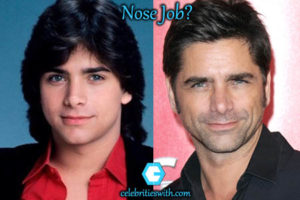 John Stamos Plastic Surgery, Botox, Nose Job, Before and After Pics ...