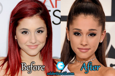 Ariana Grande Plastic Surgery: Nose Job, Fillers, Before After Pictures ...