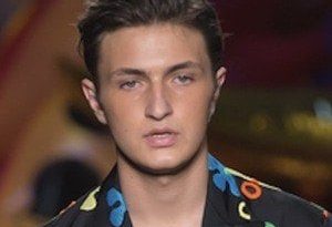 Anwar Hadid Cosmetic Surgery